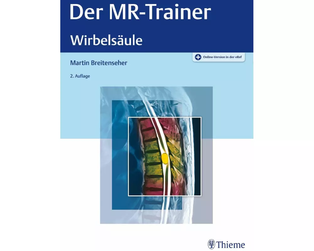 Der MR-Trainer Wirbelsäule