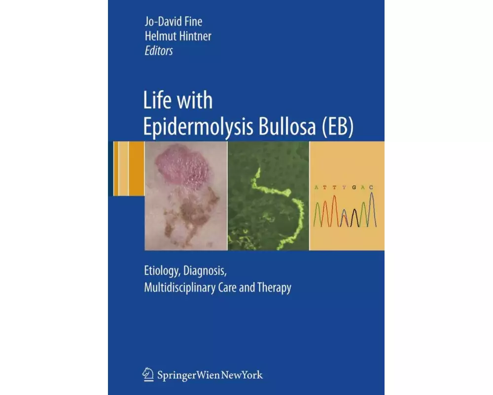 Life with Epidermolysis Bullosa (EB)