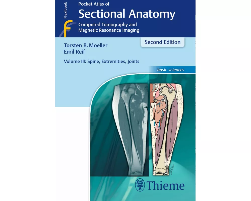 Pocket Atlas of Sectional Anatomy, Volume III: Spine, Extremities, Joints