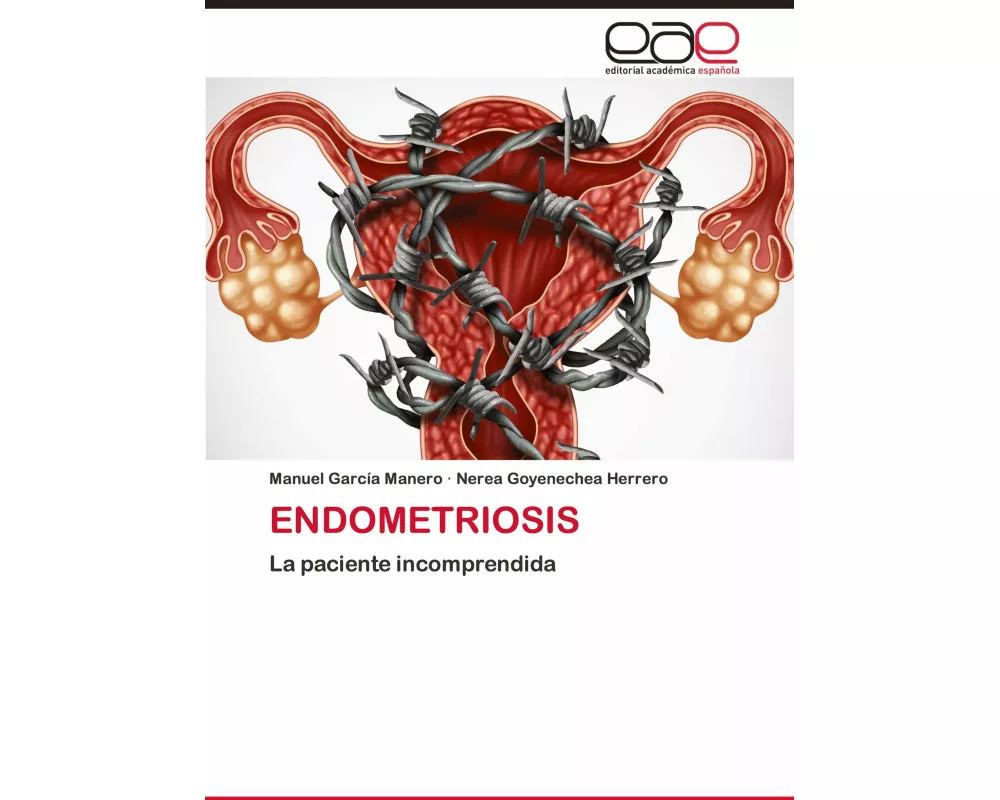 Endometriosis
