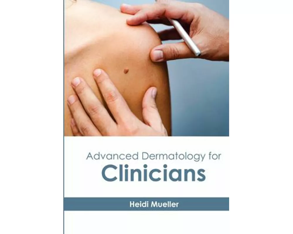 Advanced Dermatology for Clinicians