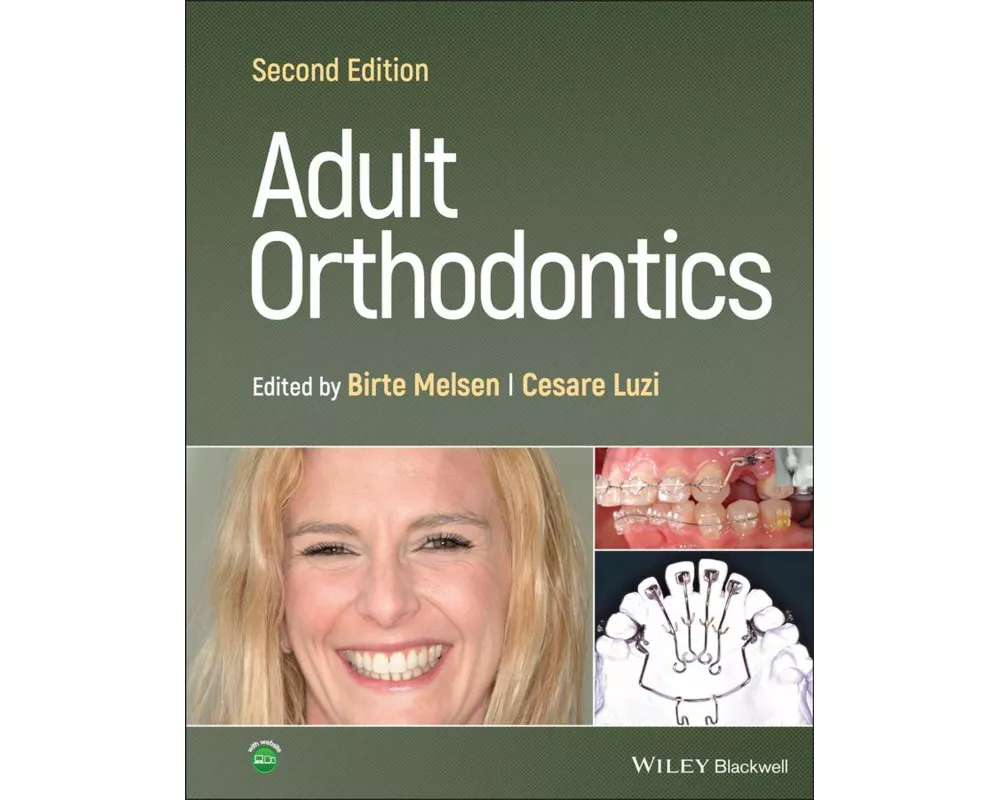 Adult Orthodontics