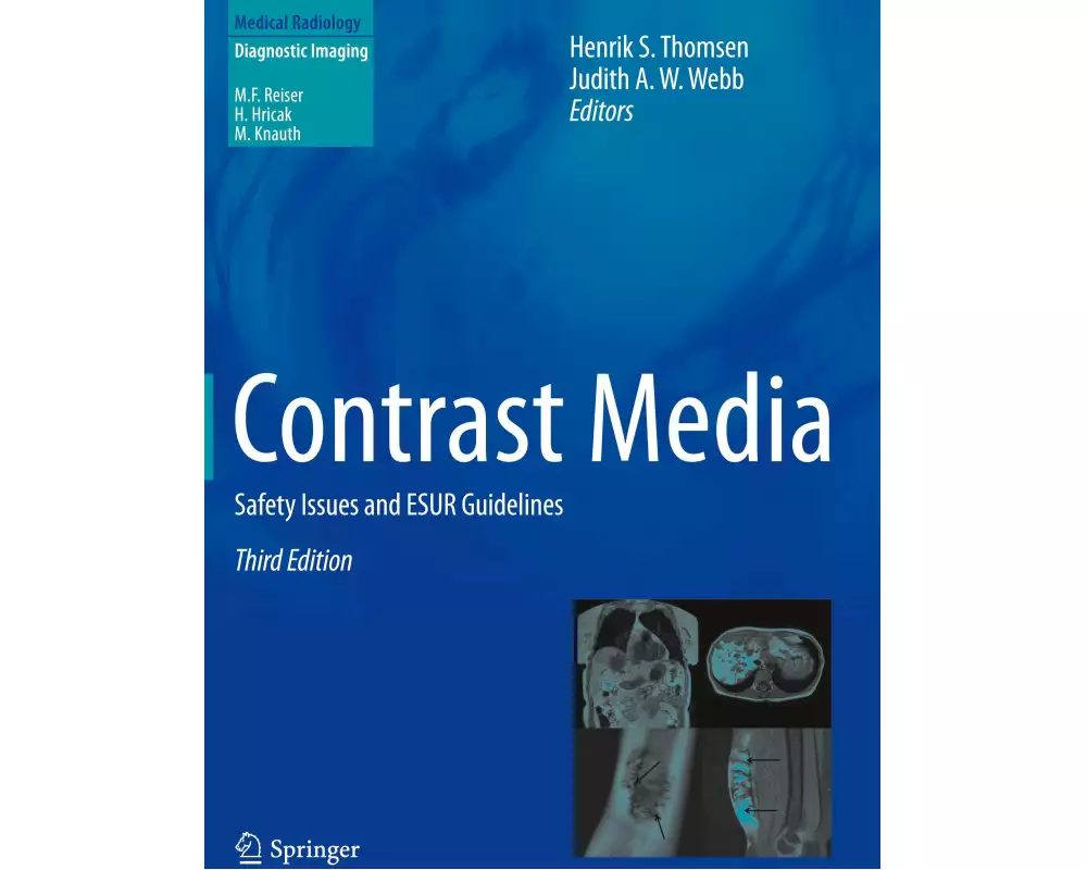Contrast Media