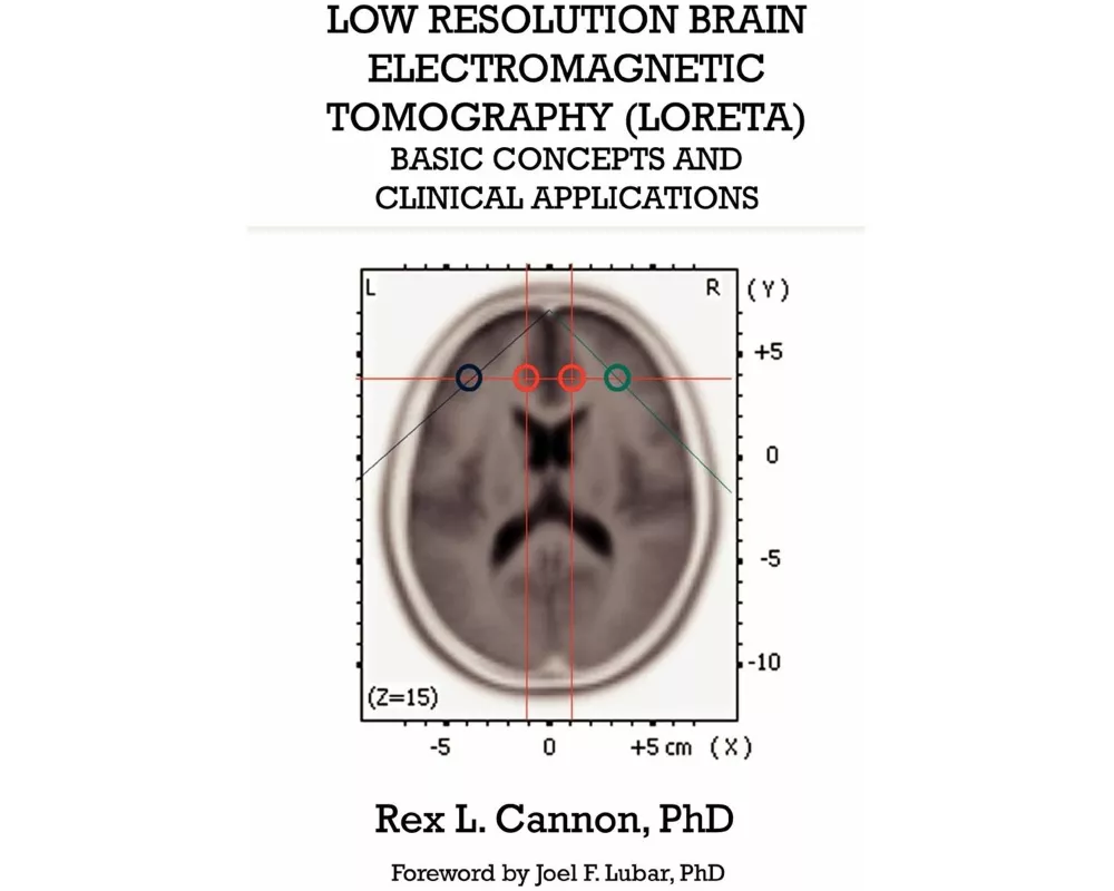 Low Resolution Brain Electromagnetic Tomography (LORETA)