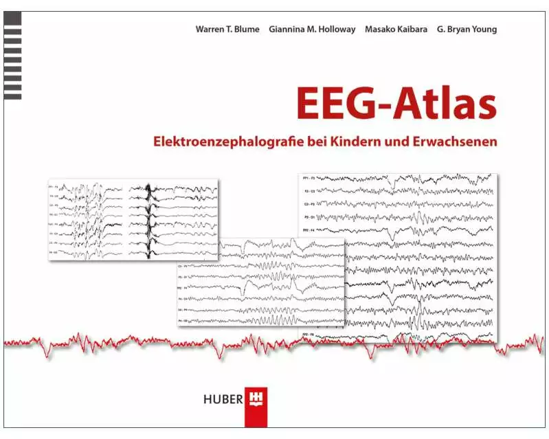 EEG–Atlas