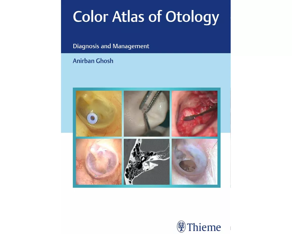 Color Atlas of Otology