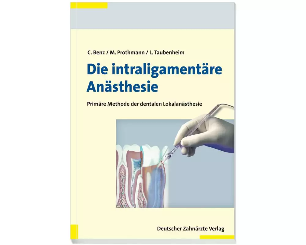 Die intraligamentäre Anästhesie
