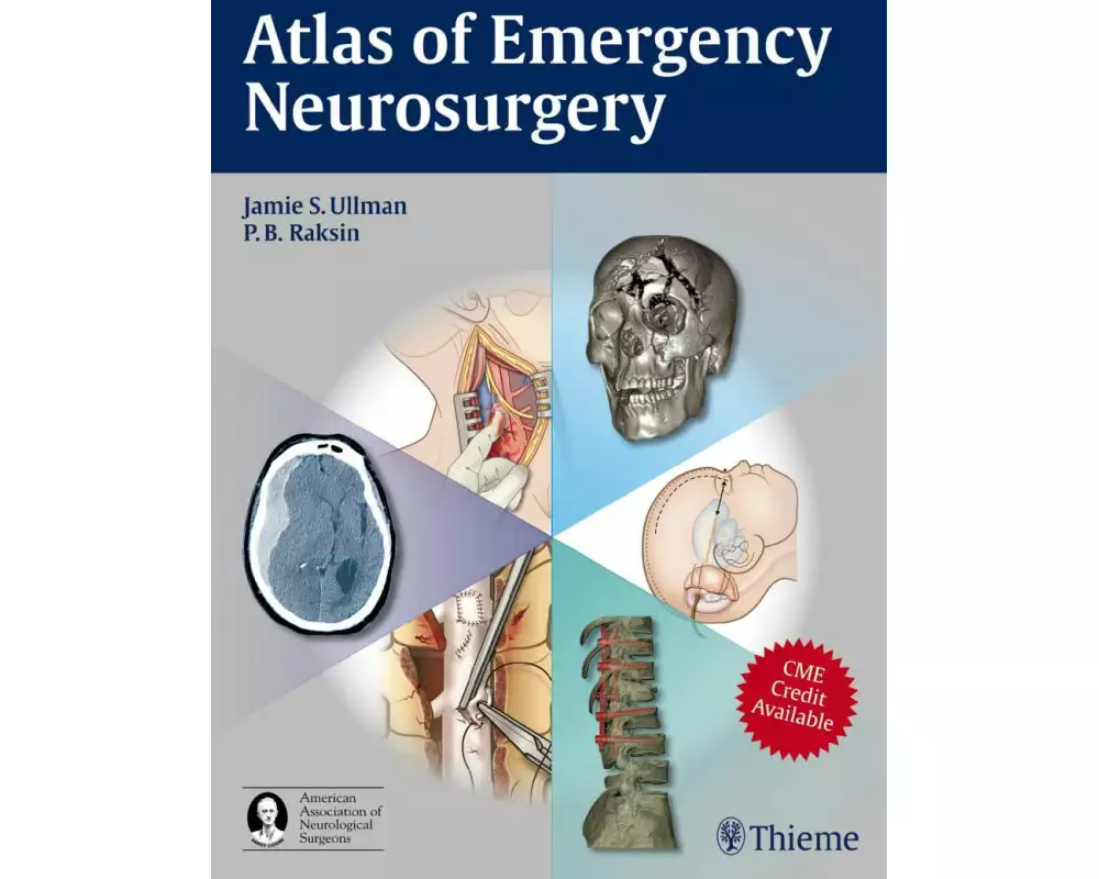 Atlas of Emergency Neurosurgery