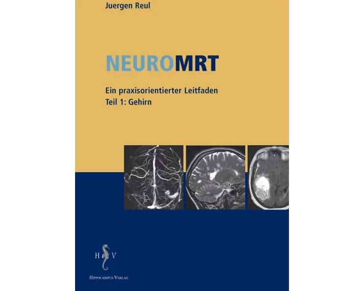 NeuroMRT 1