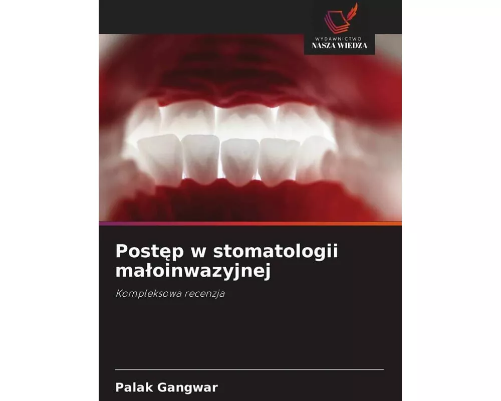 Post¿p w stomatologii ma¿oinwazyjnej