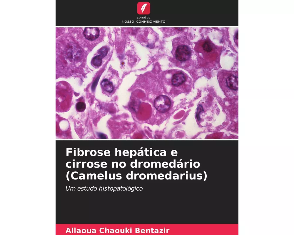 Fibrose hepática e cirrose no dromedário (Camelus dromedarius)
