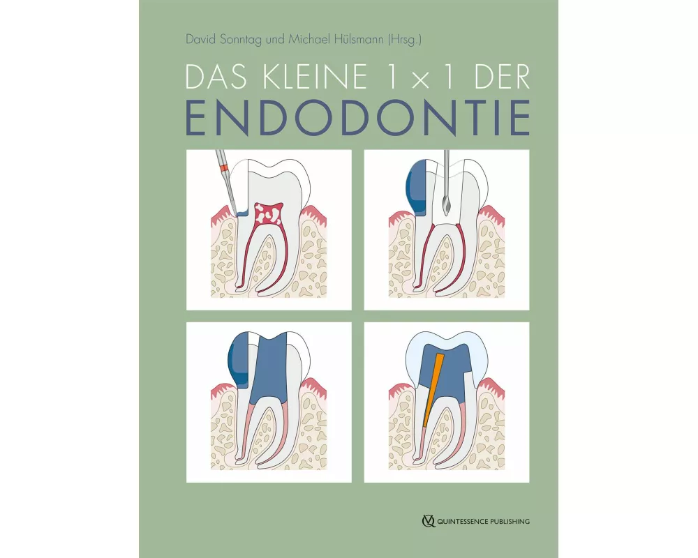 Das kleine 1x1 der Endodontie