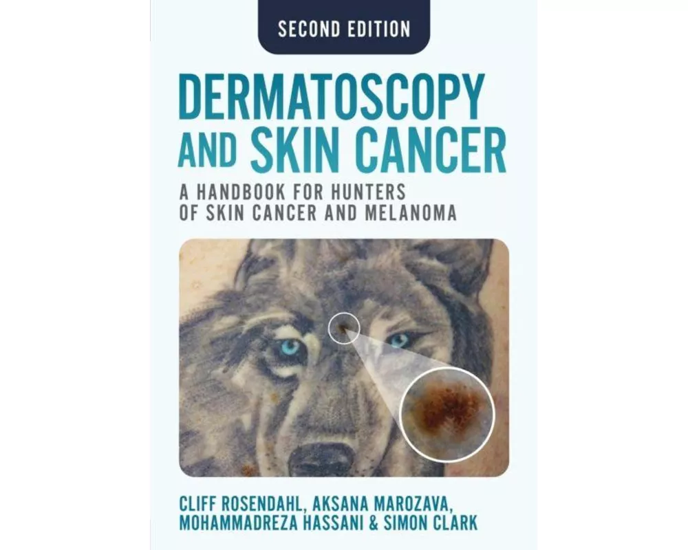 Dermatoscopy and Skin Cancer, second edition