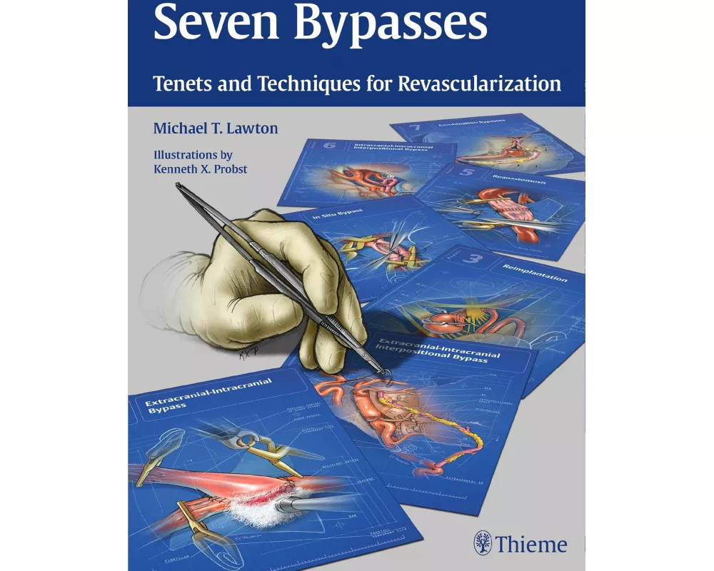 Seven Bypasses