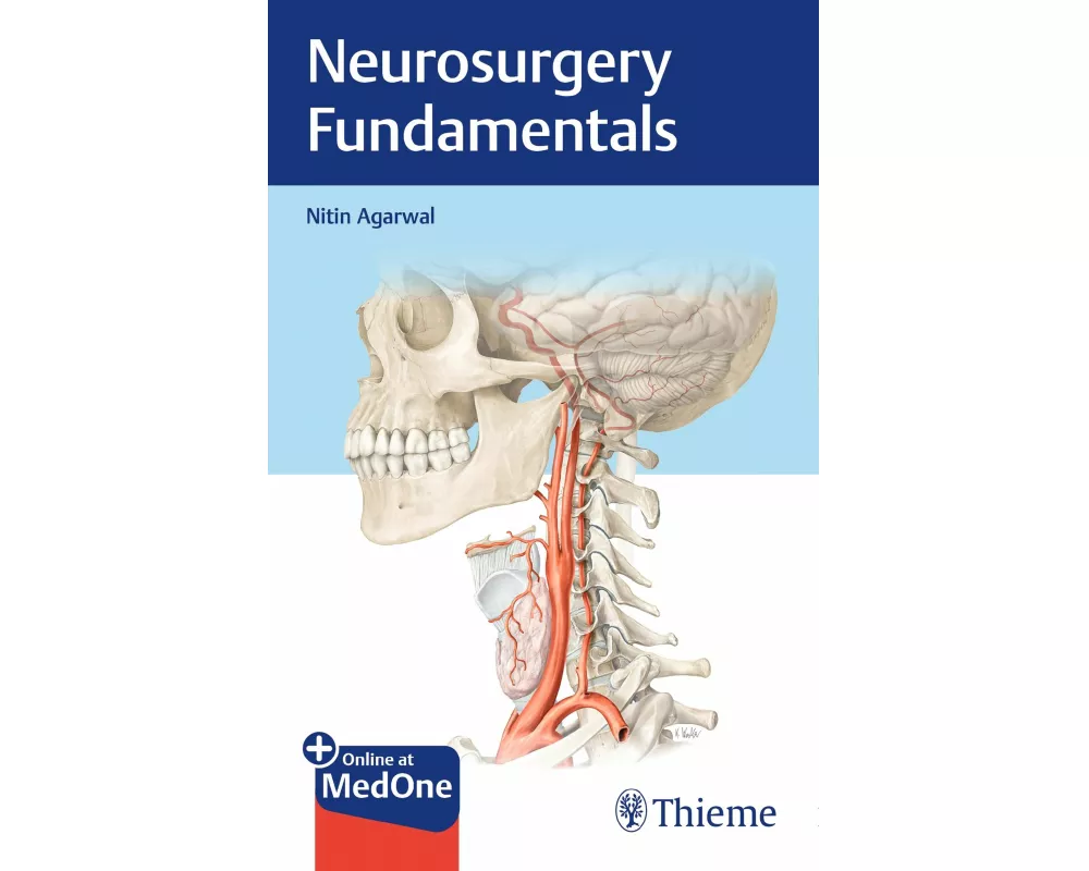 Neurosurgery Fundamentals