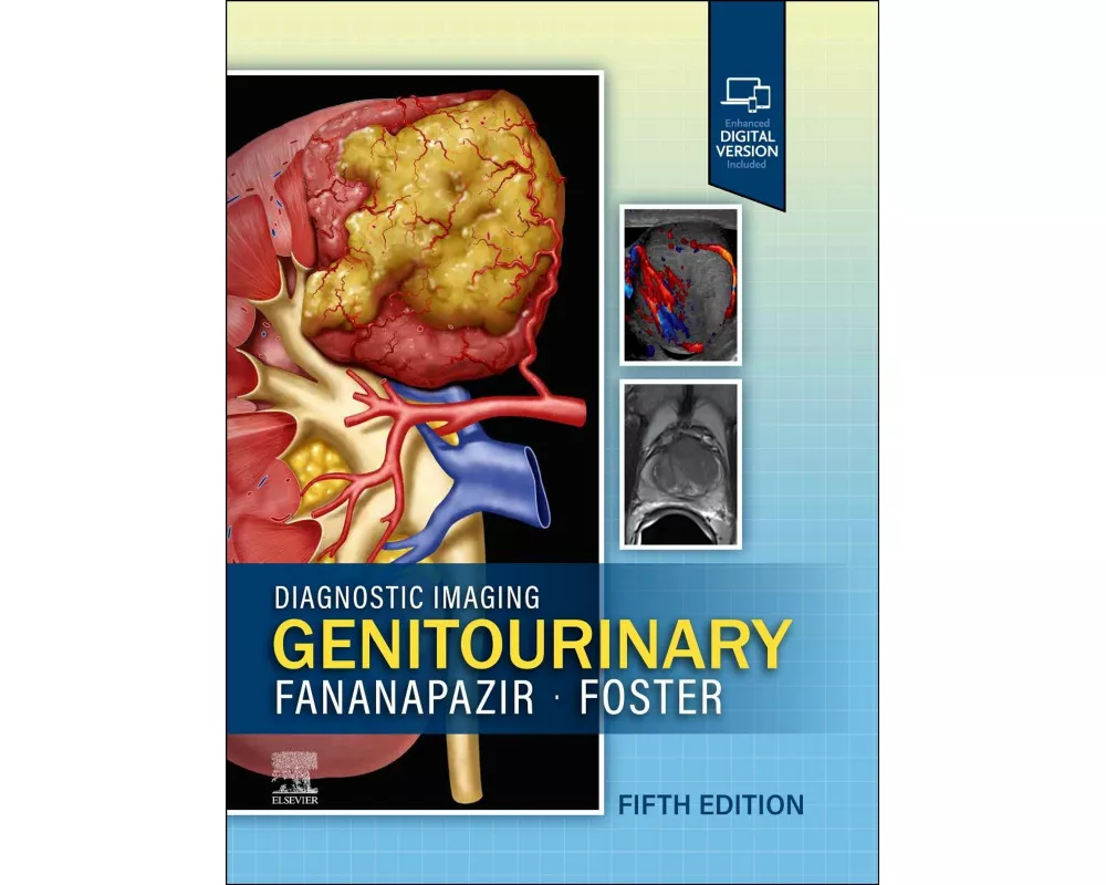 Diagnostic Imaging: Genitourinary