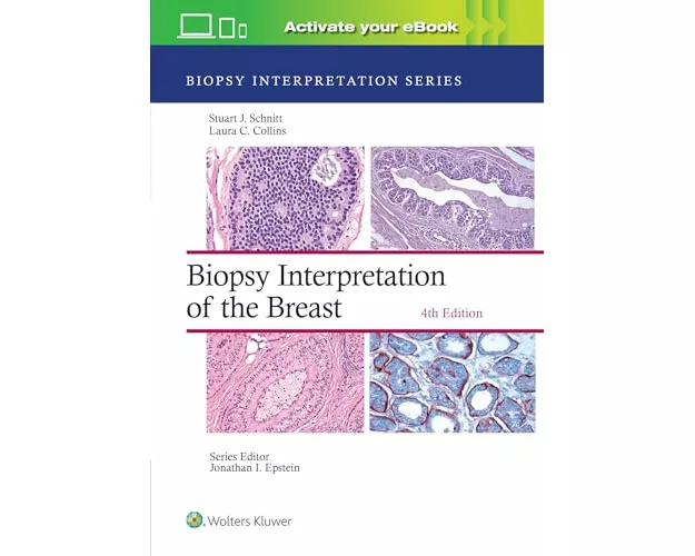 Biopsy Interpretation of the Breast: Print + eBook with Multimedia