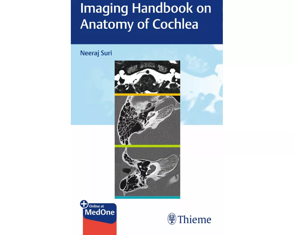 Imaging Handbook on Anatomy of Cochlea