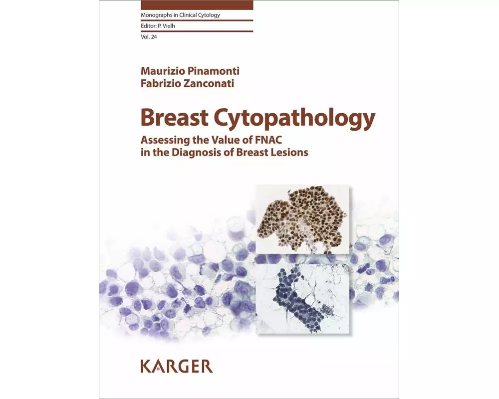 Breast Cytopathology