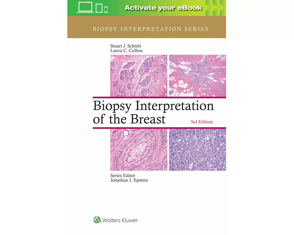 Biopsy Interpretation of the Breast