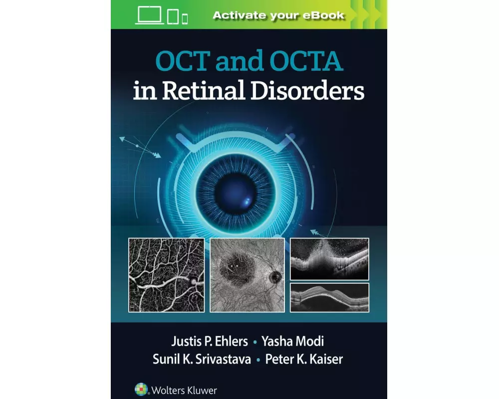 OCT and OCTA in Retinal Disorders