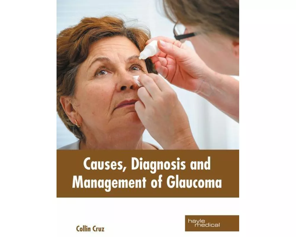 Causes, Diagnosis and Management of Glaucoma