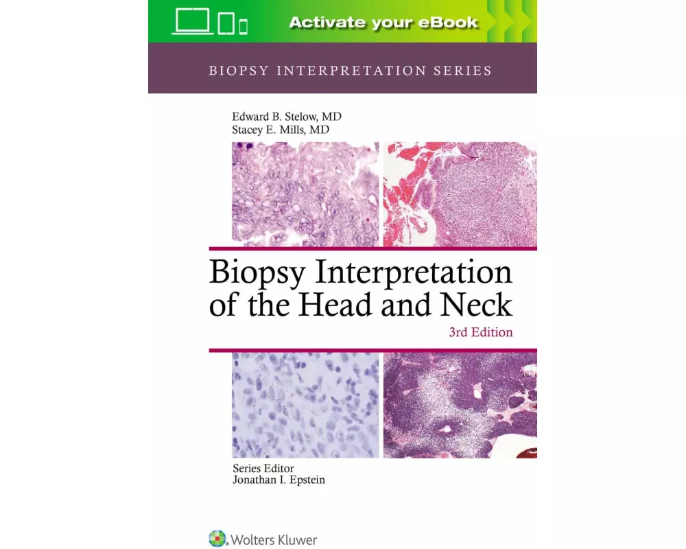 Biopsy Interpretation of the Head and Neck