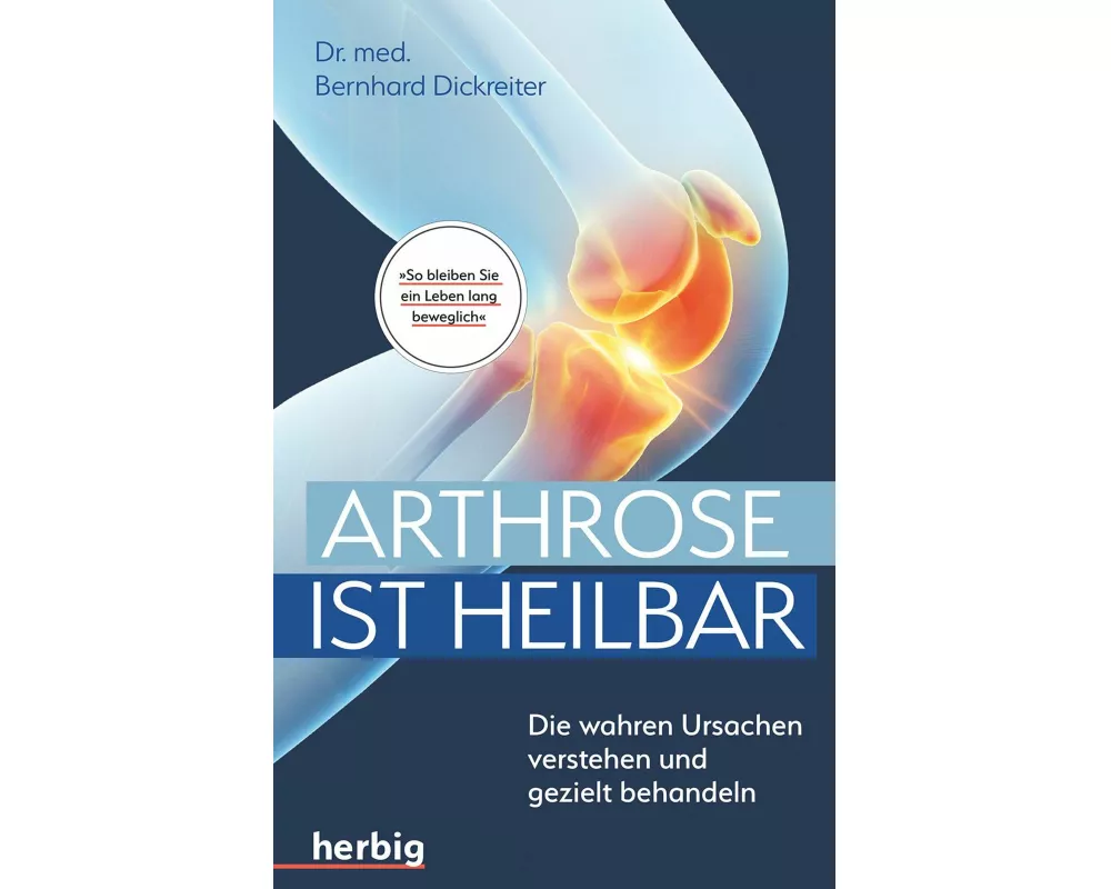 Arthrose ist heilbar