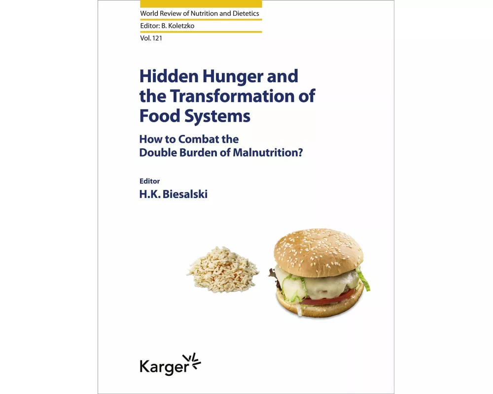 Hidden Hunger and the Transformation of Food Systems