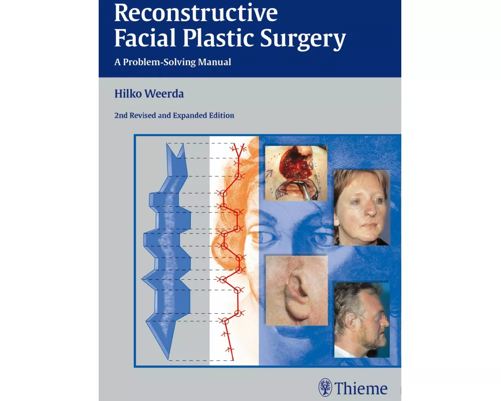 Reconstructive Facial Plastic Surgery