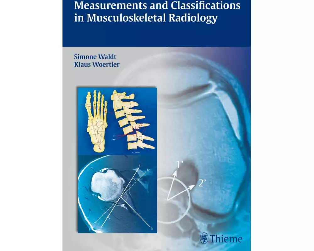 Measurements and Classifications in Musculoskeletal Radiology