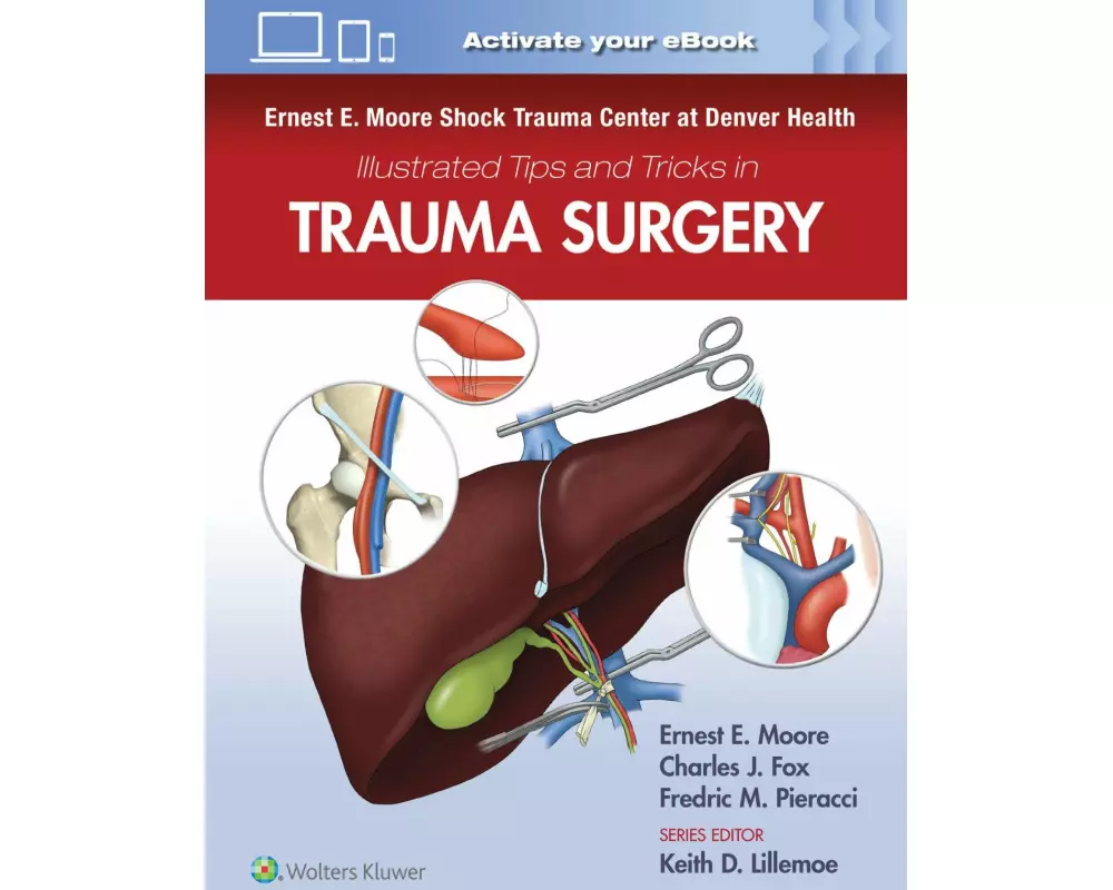 Ernest E. Moore Shock Trauma Center at Denver Health Illustrated Tips and Tricks in Trauma Surgery