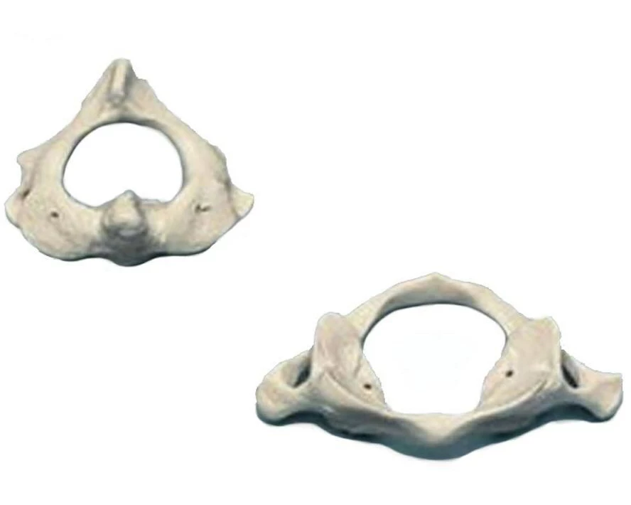 Rüdiger Skelett Atlas & Axis