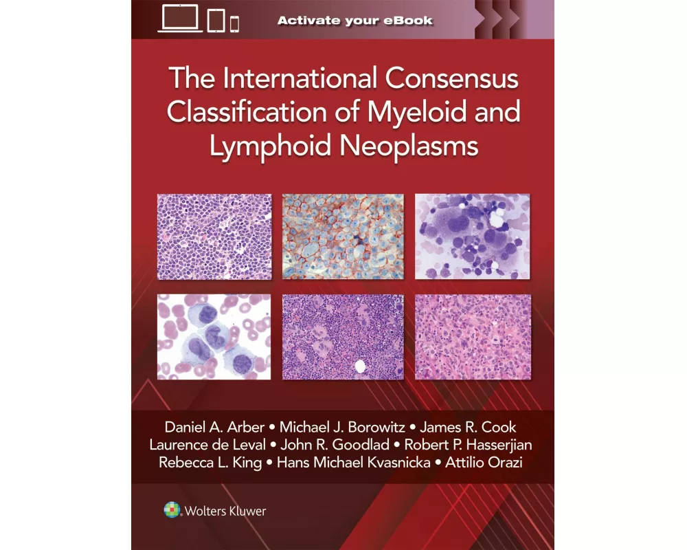 The International Consensus Classification of Myeloid and Lymphoid Neoplasms