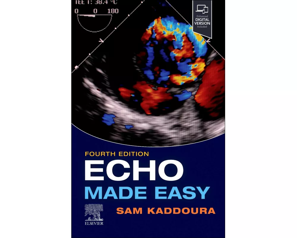 Echo Made Easy