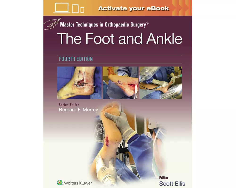 Master Techniques in Orthopaedic Surgery: The Foot and Ankle: Print + eBook with Multimedia
