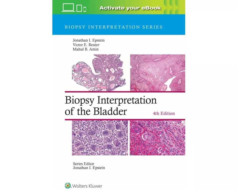 Biopsy Interpretation of the Bladder: Print + eBook with Multimedia