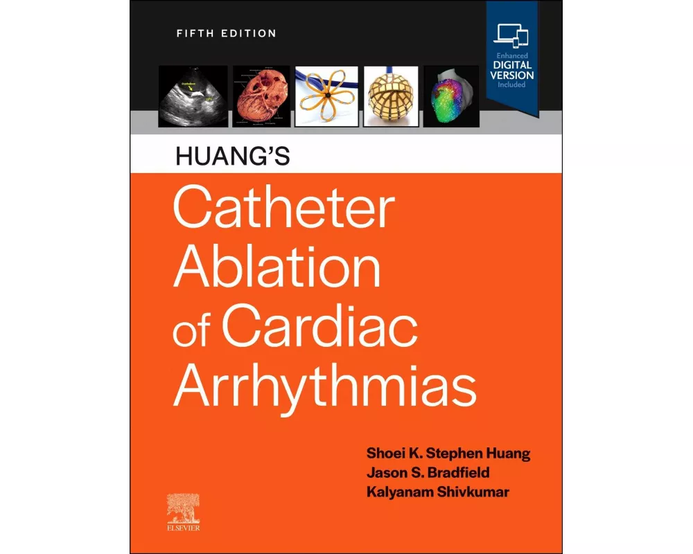 Huang's Catheter Ablation of Cardiac Arrhythmias