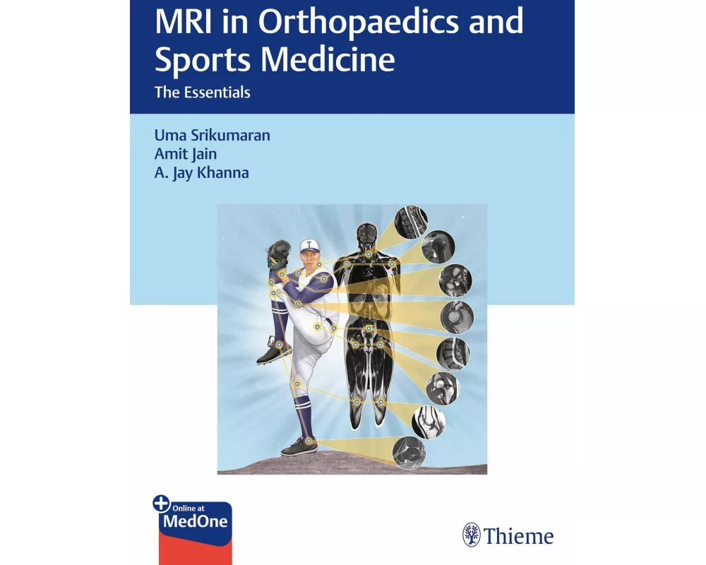 MRI in Orthopaedics and Sports Medicine