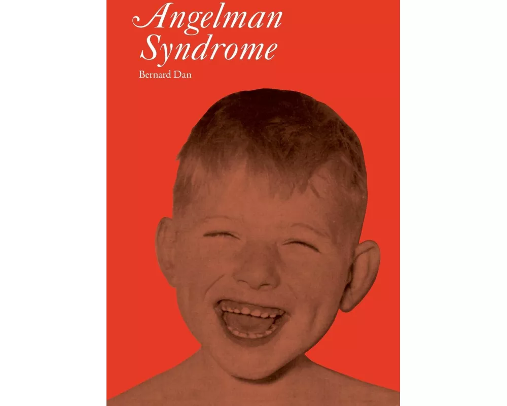 Angelman Syndrome