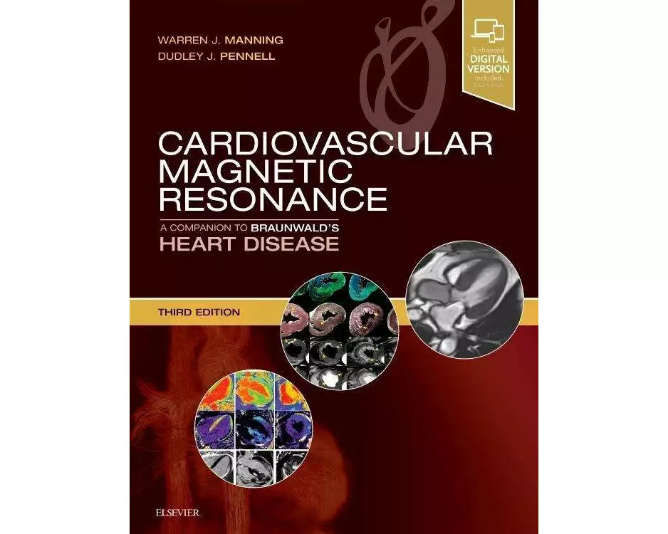 Cardiovascular Magnetic Resonance