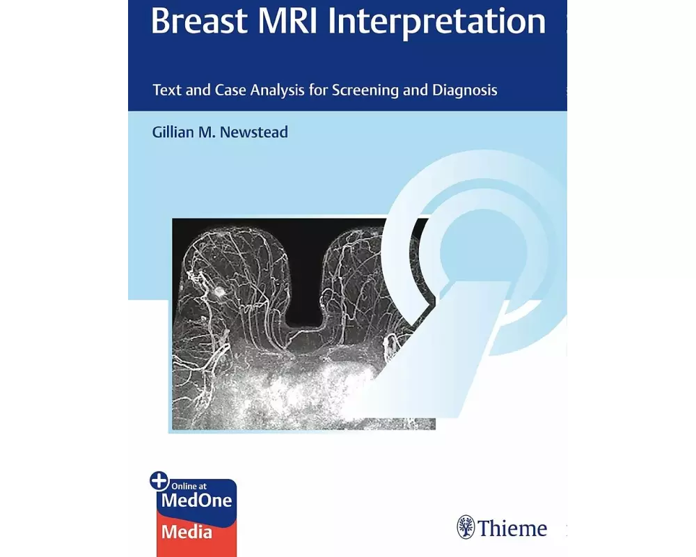 Breast MRI Interpretation