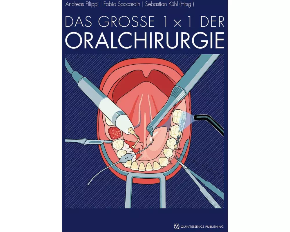 Das große 1 x 1 der Oralchirurgie