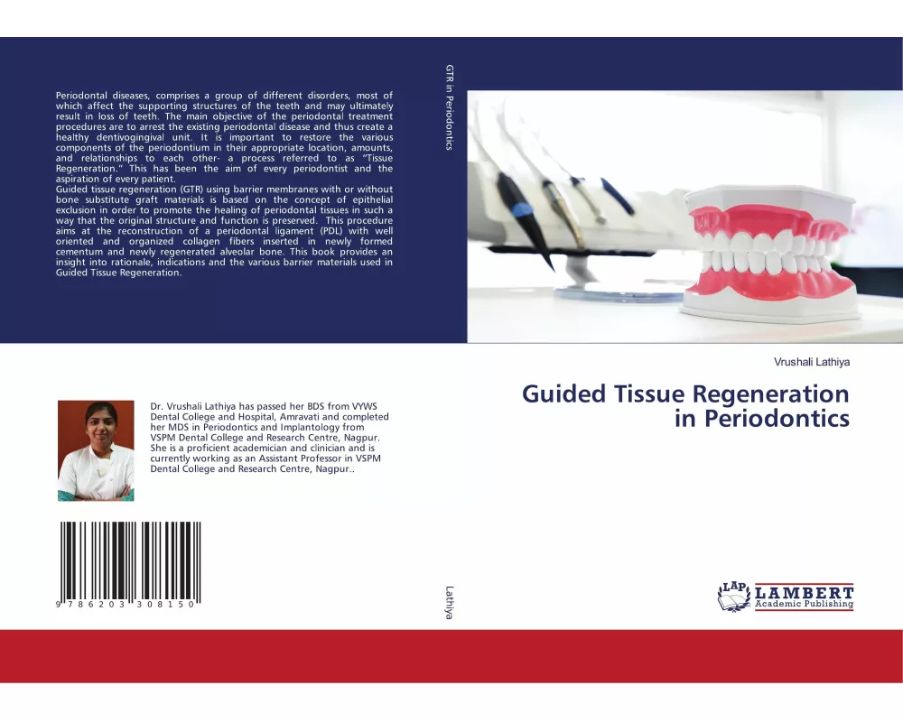 Guided Tissue Regeneration in Periodontics