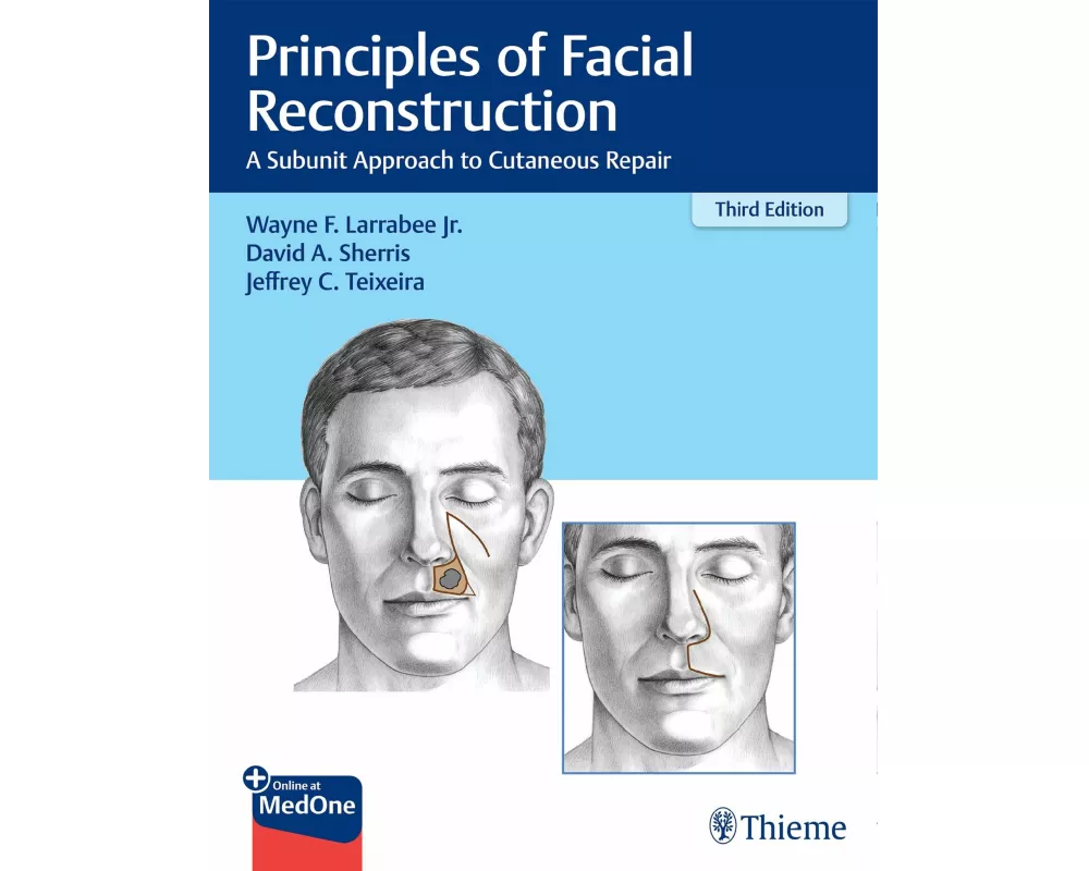Principles of Facial Reconstruction