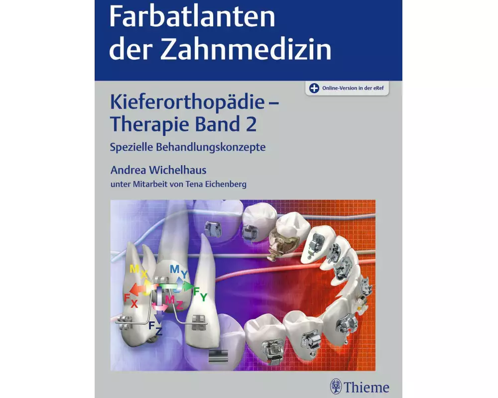 Kieferorthopädie - Therapie Band 2
