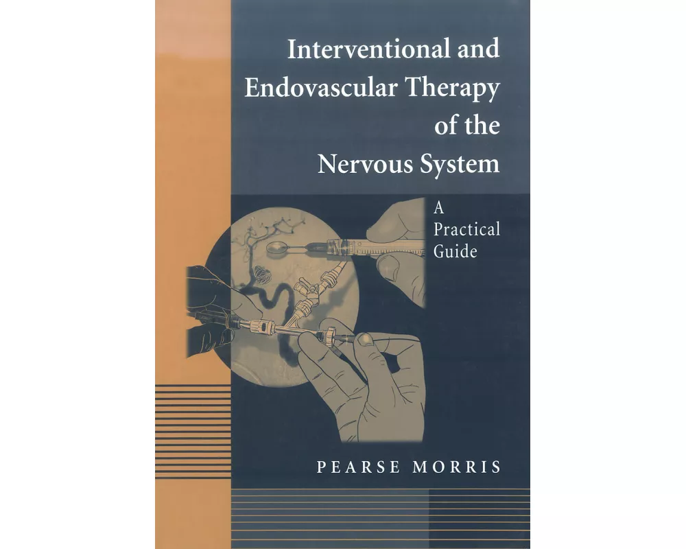 Interventional and Endovascular Therapy of the Nervous System