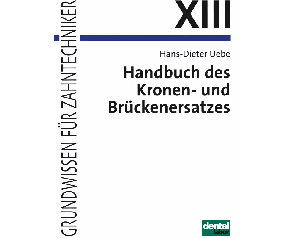 Handbuch des Kronen- und Brückenersatzes