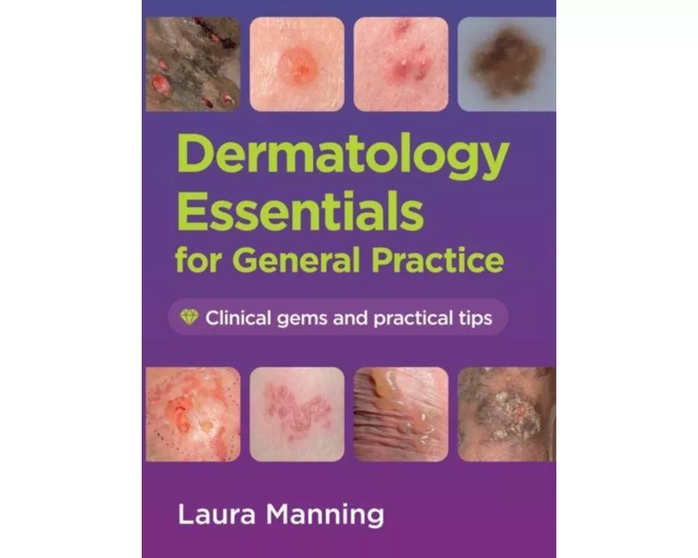 Dermatology Essentials for General Practice