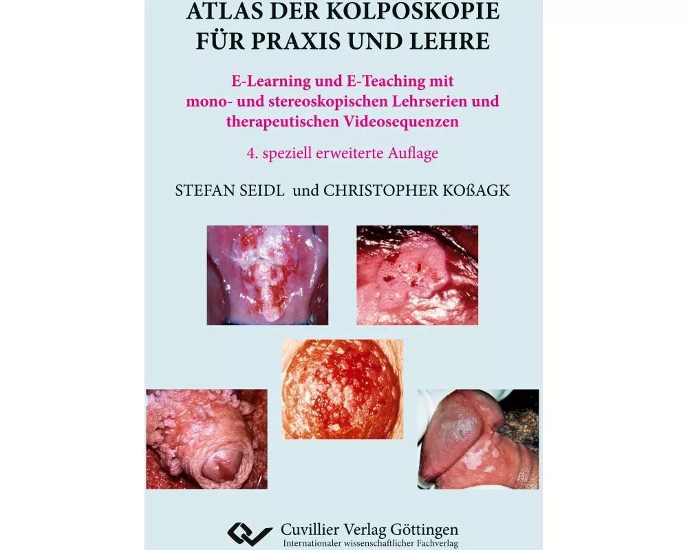 Atlas der Kolposkopie für Praxis und Lehre. E-Learning und E-Teaching mit mono- und stereoskopischen Lehrserien und therapeutischen Videosequenzen